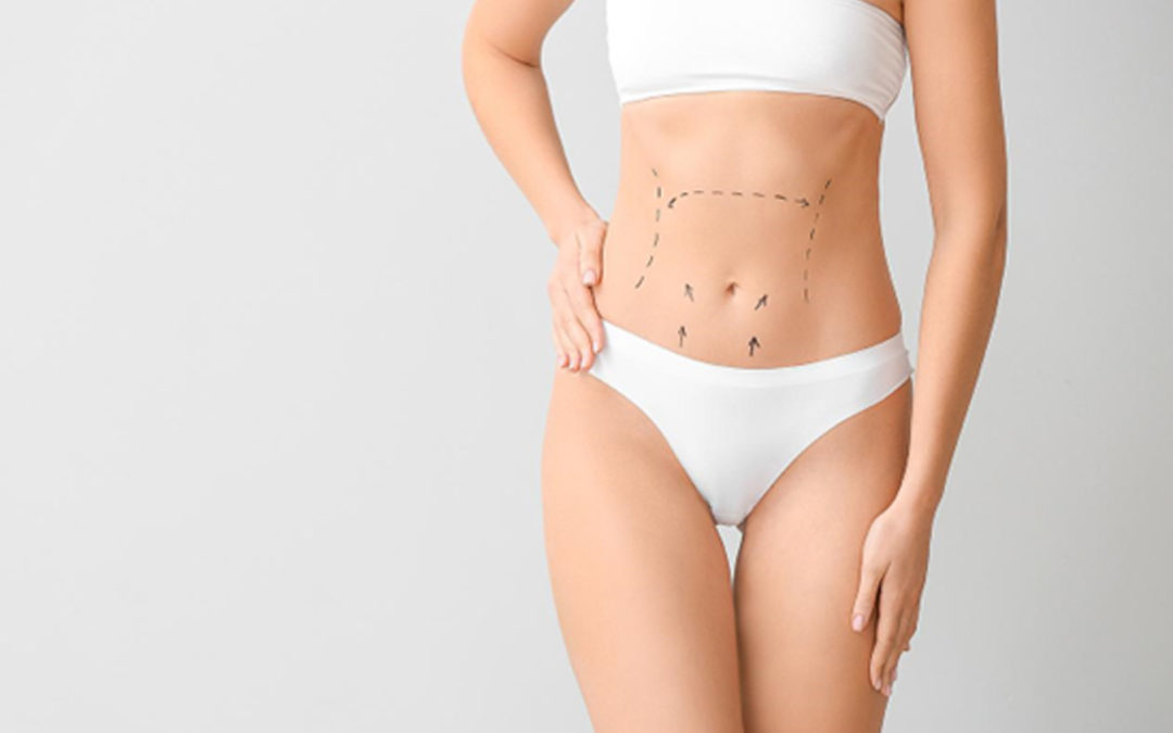 Prix d'une abdominoplastie en Tunisie