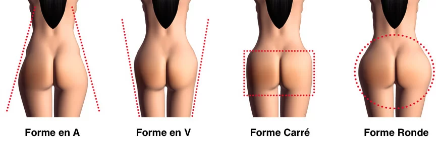 augmentation des fesses en Tunisie