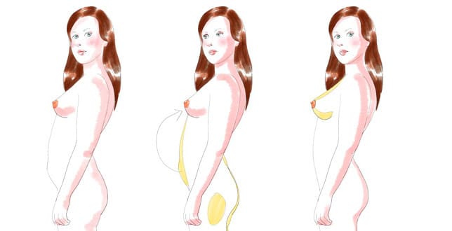 prix lipofilling-seins