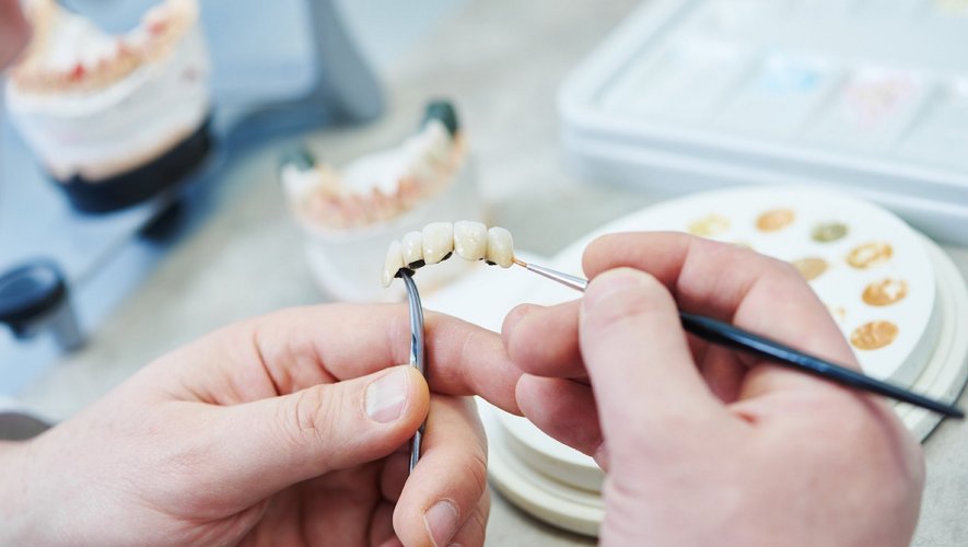 prothèse dentaire en Tunisie